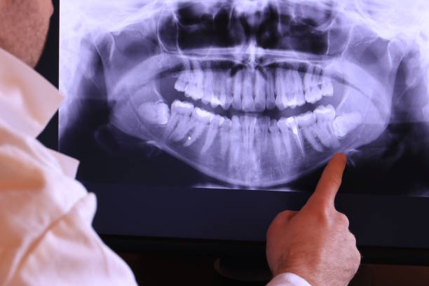 Best Holiday Emergency Dentist in Park River, ND