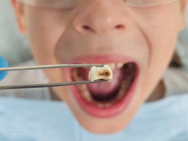 Best Emergency Dentist for Special Needs Patients in Park River, ND